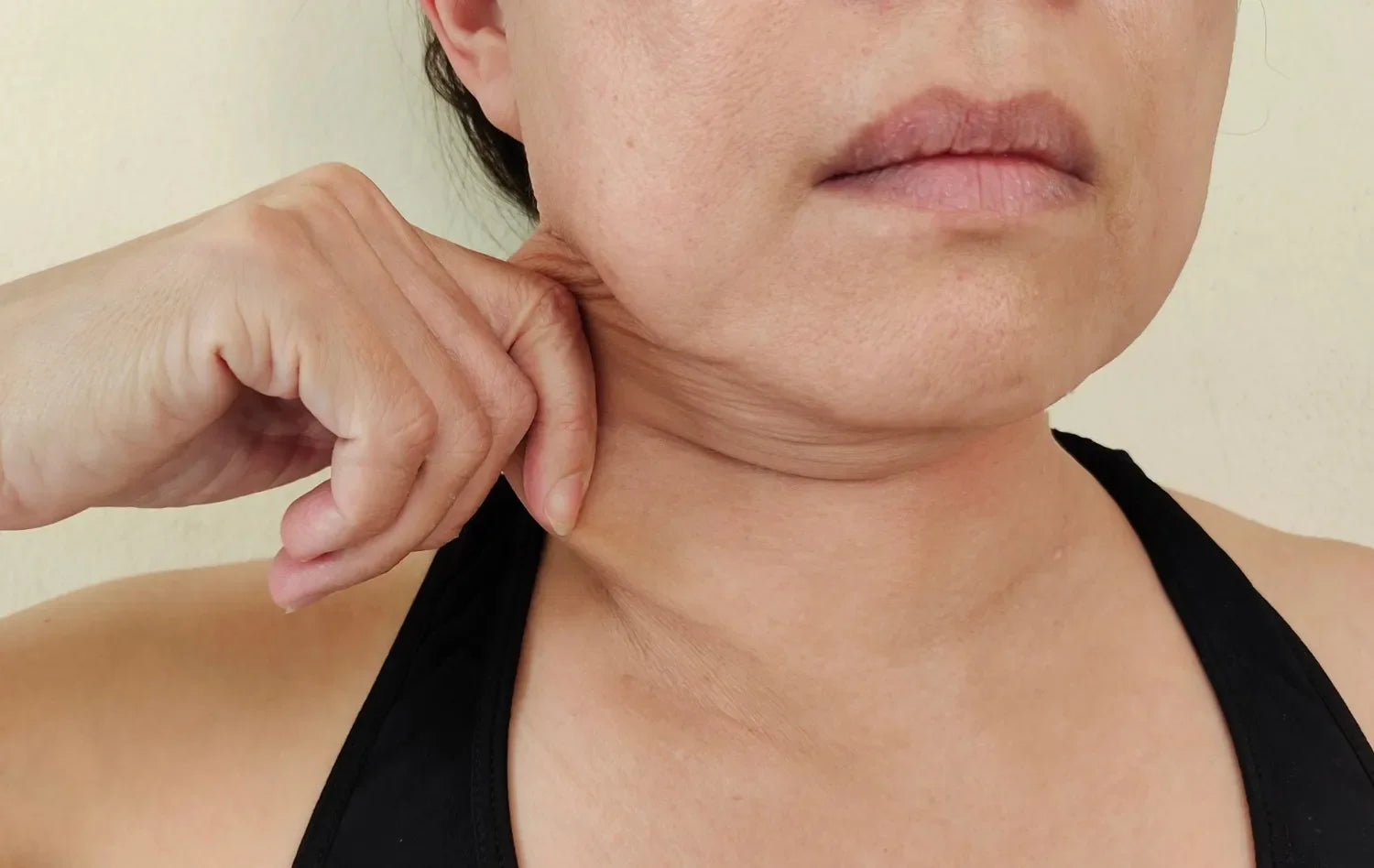 Factors affecting Neck Aging