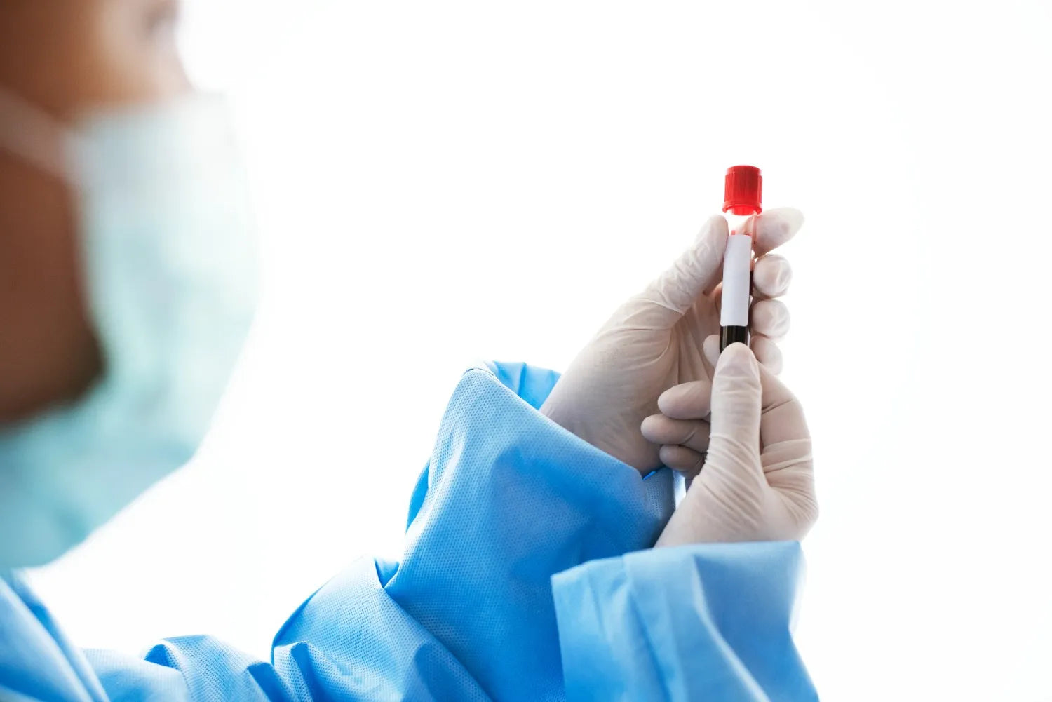 Do NAD levels change with age?
